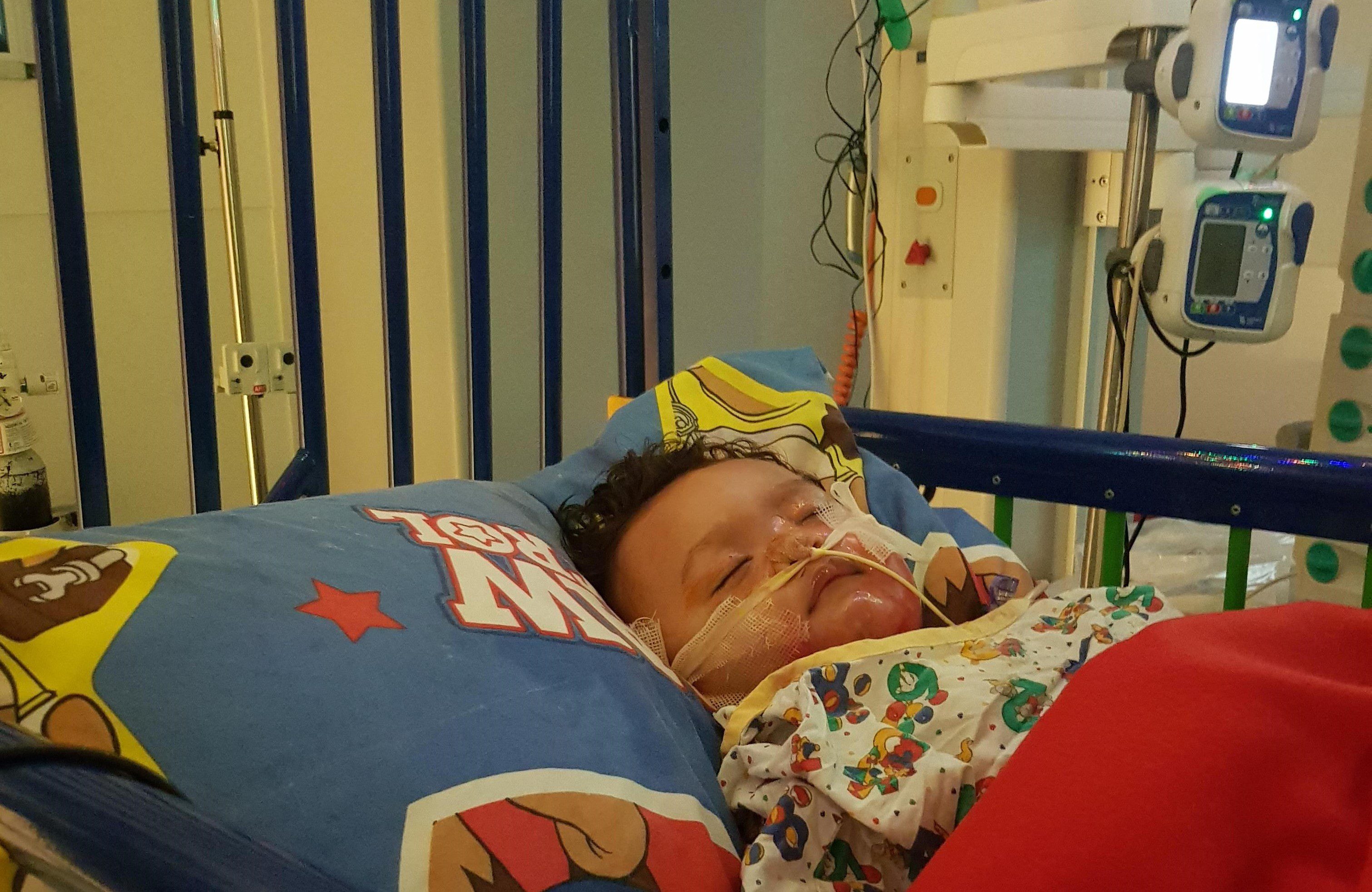 Baby Charlie in hospital following surgery.